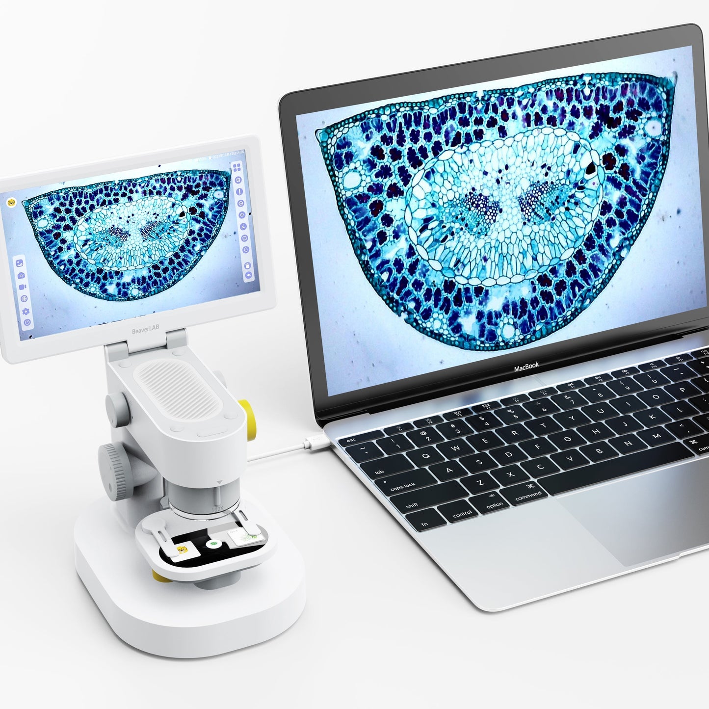 Detachable Digital Microscope